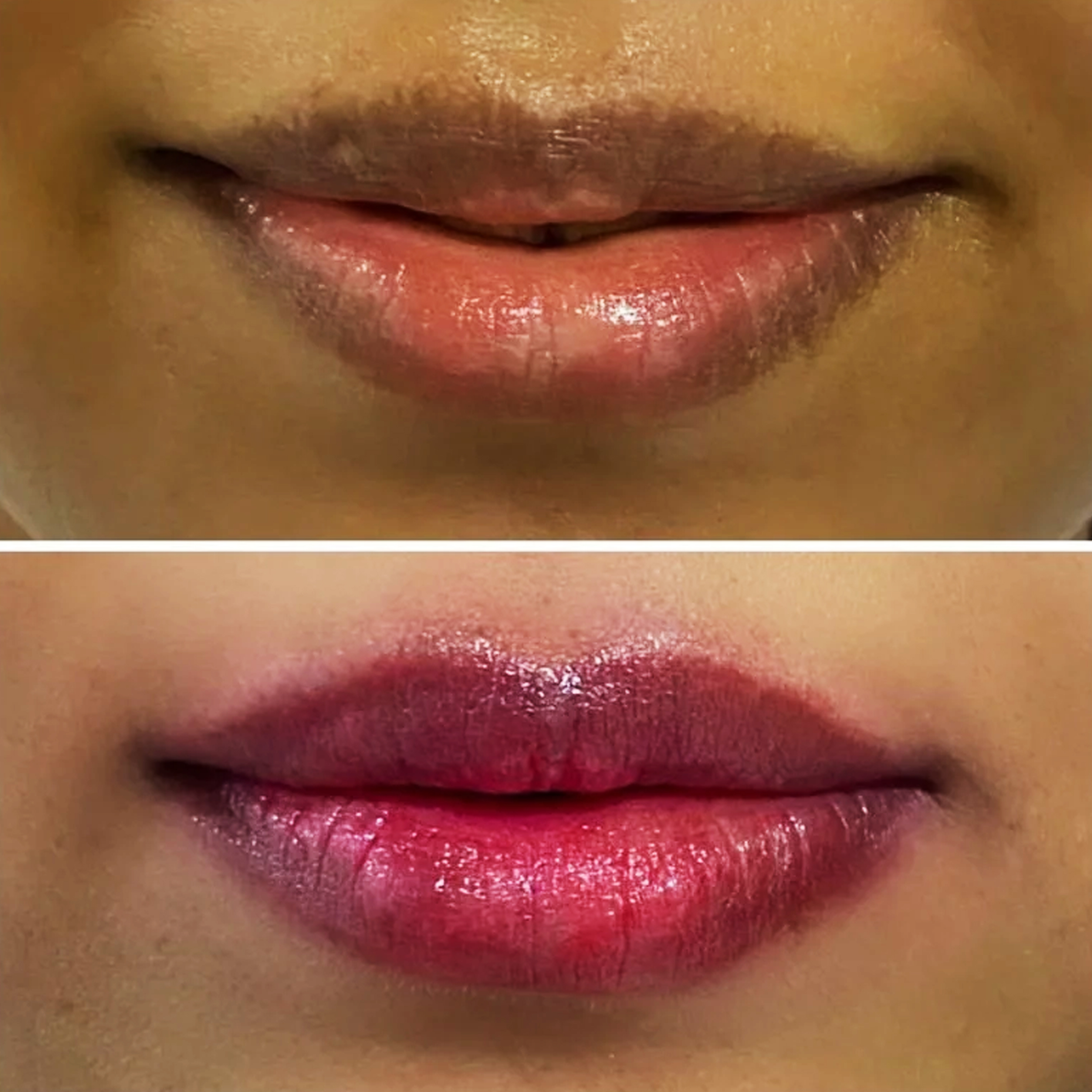 gro-hair-glo-skin-bannerghatta