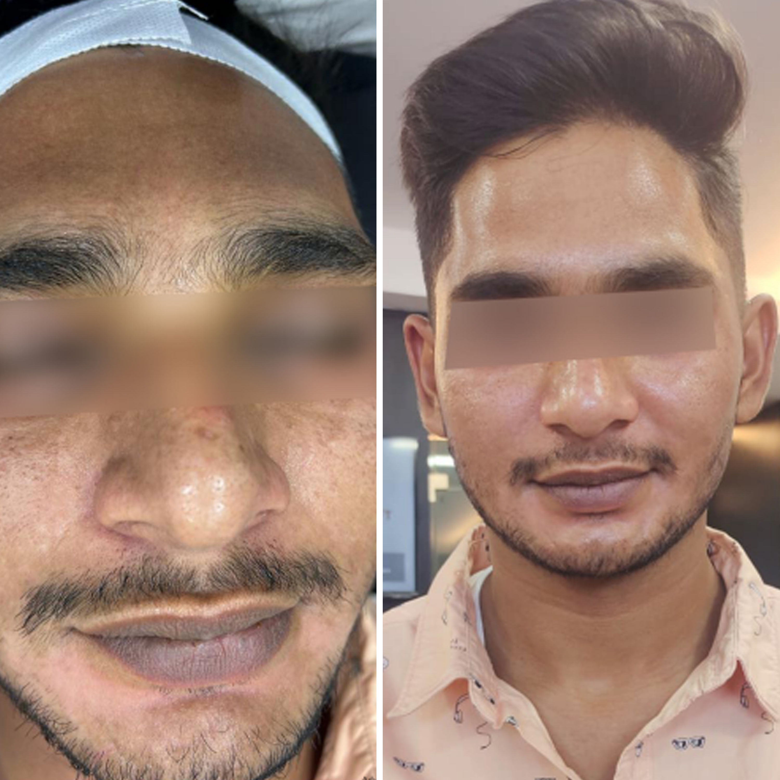 gro-hair-glo-skin-bannerghatta