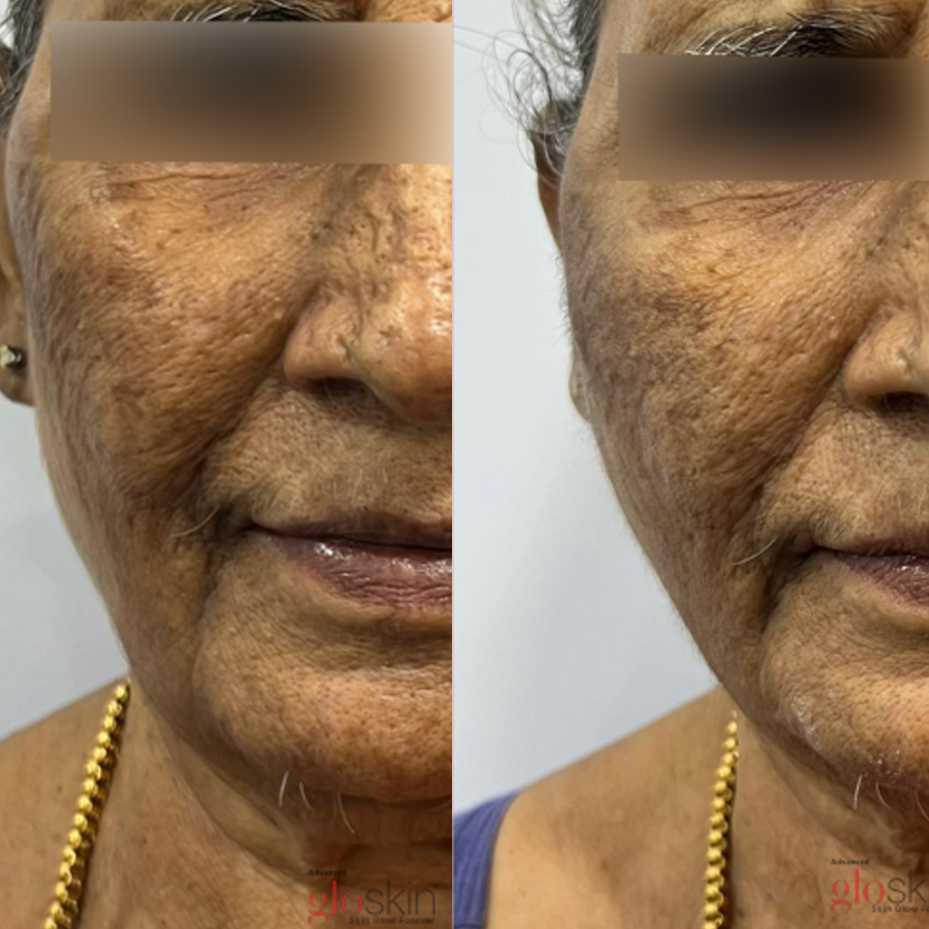 gro-hair-glo-skin-bannerghatta