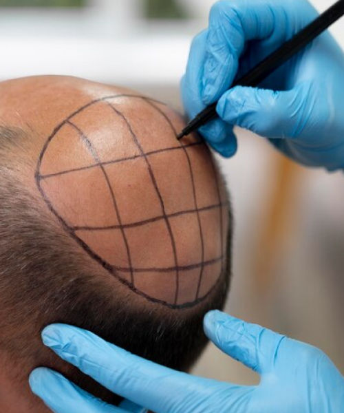 gro-hair-glo-skin-bannerghatta