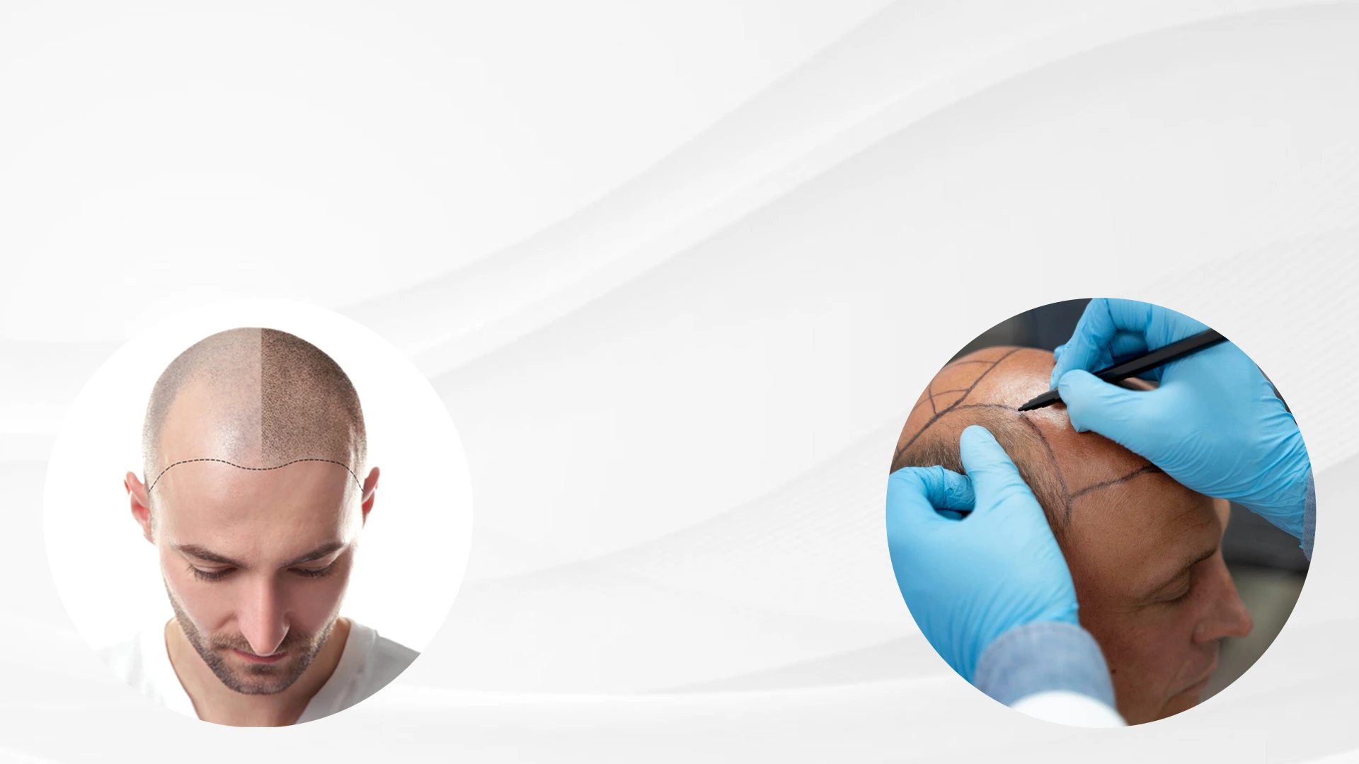 gro-hair-glo-skin-bannerghatta